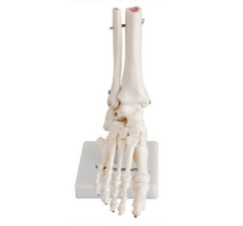 From model to practice: Application of the bigfoot joint model in foot surgery simulation