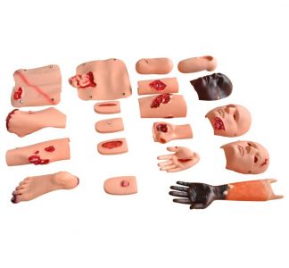 How does the Trauma assessment module ensure the accuracy of the assessment?