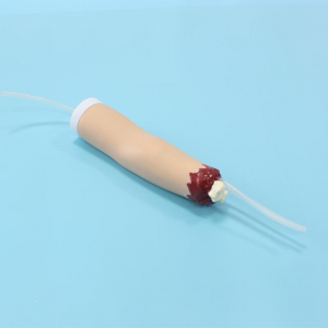 What will be the development trend of hemostatic model of upper limb trauma amputation in the future?