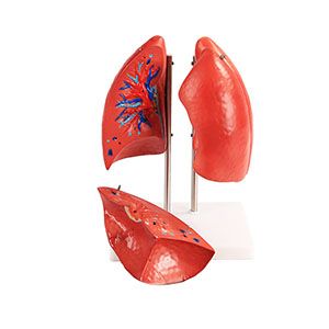 The market demand for lung anatomical models is growing, what is behind it?