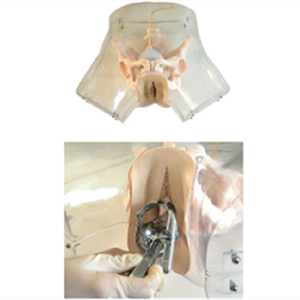 What skills does the transparent curettage model provide for personal growth that can be accumulated over the long term?