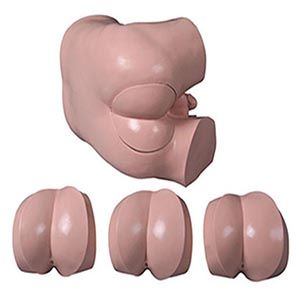 Advanced digital rectal examination model