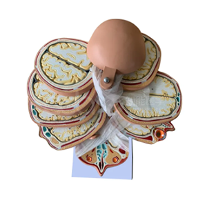 A horizontal incision model of the human head and skull