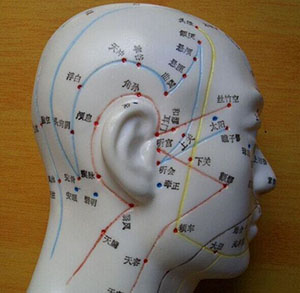 Head acupuncture model