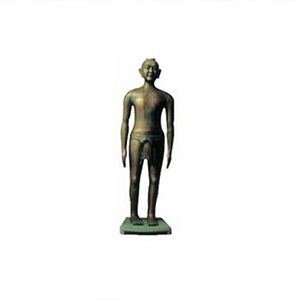 Visit acupuncture bronze Figure