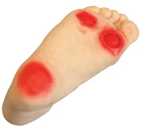 Diabetic Foot Care Model